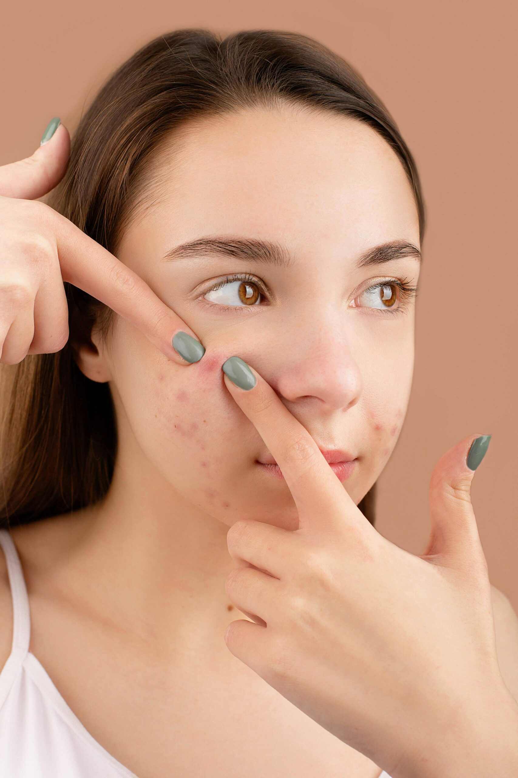 A young woman with acne pricking her face in a studio shoot.